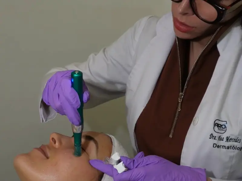 Dermapen
