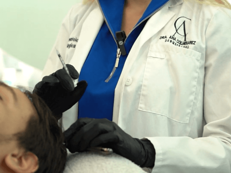 Mesoterapia Capilar - Dra. Ana Colmenarez
