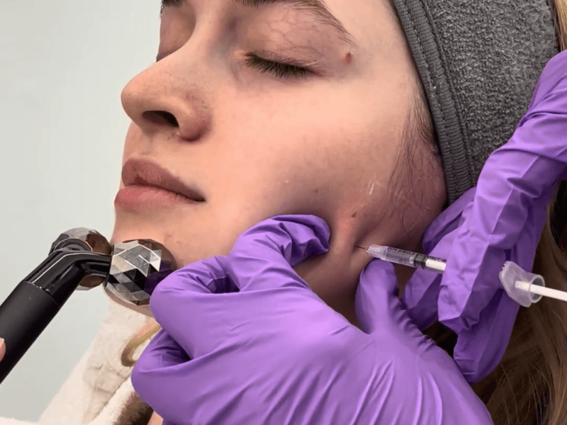 Botox para Bruxismo - Dra. Ana Colmenarez