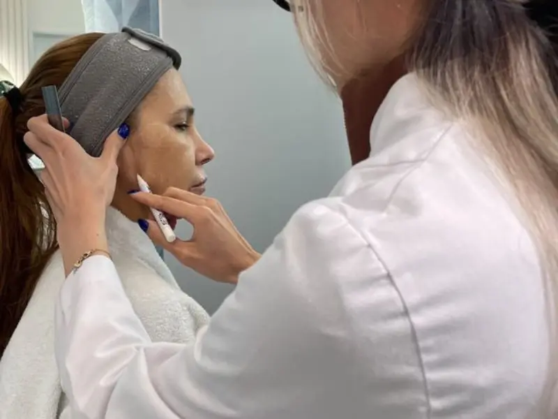 Bioestimuladores de Colágeno